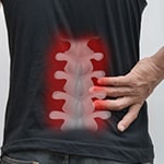 Spinal Cord Injuries